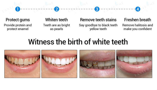 3D White Teeth Whitening Pen Tooth Gel Whitener Bleach
